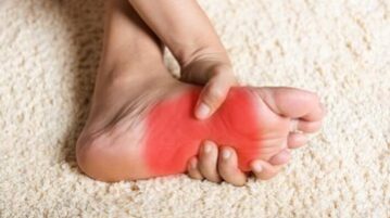 داغی و سوزش کف پا نشانه چیست؟